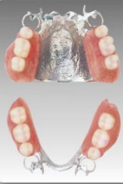 チタン床義歯