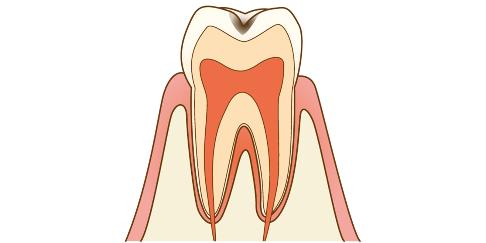 C1