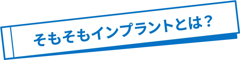 そもそもインプラントとは？