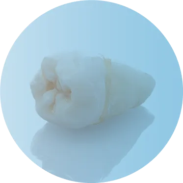 周囲の歯や顎へ負担がかかりさらに歯が抜ける