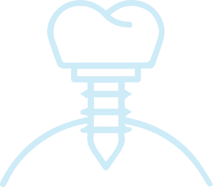 インプラント治療の流れ