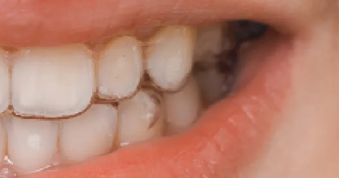 2 気になるところを撮影